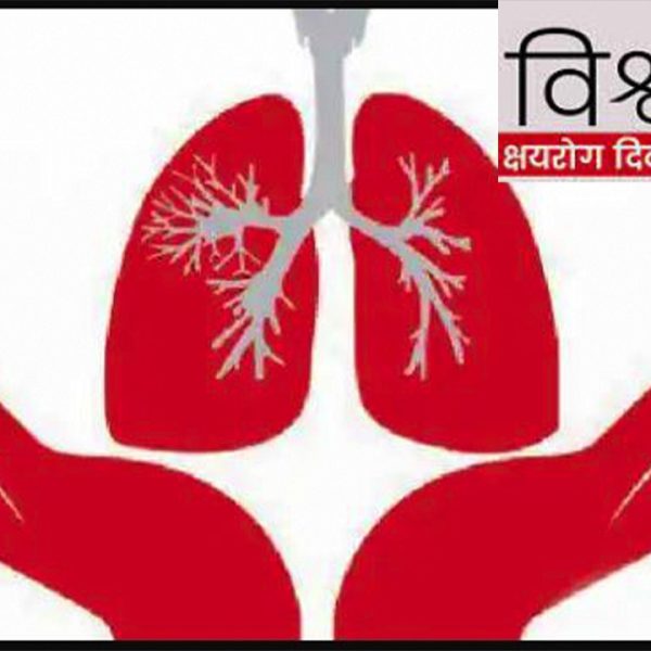 आज विश्व क्षयरोग दिवसः&hellip;